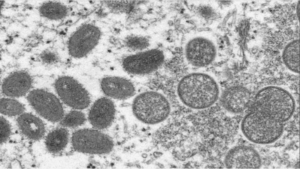 Moléculas de viruela del mono Foto: BBC