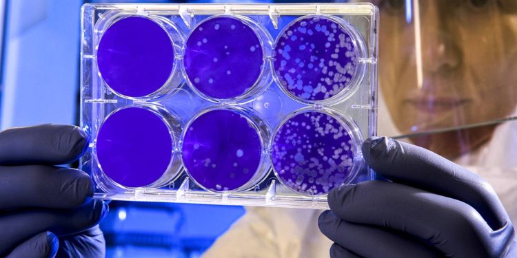 #Covid19 | Estudios explican porque la nueva cepa B117 es tan contagiosa