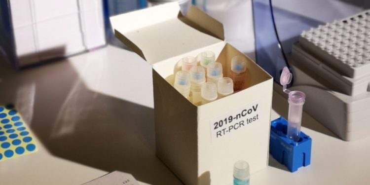 #Salud | Bioanalistas en Carabobo insisten en descentralizar pruebas PCR