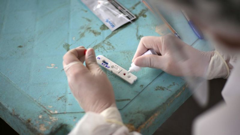 Brasil detectó nueva cepa de la covid-19 con una combinación de 18 mutaciones