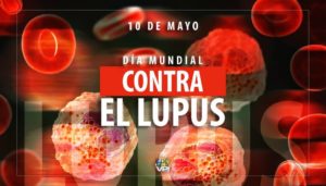 Lupus