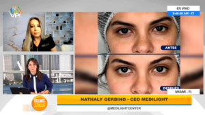 Plasma, la nueva técnica para el rejuvenecimiento de la piel
